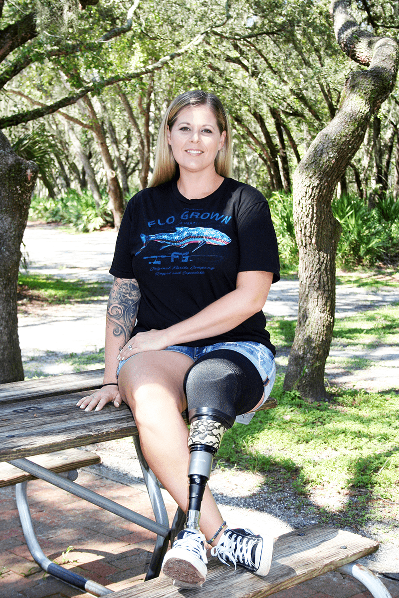 woman beautiful prosthetic leg