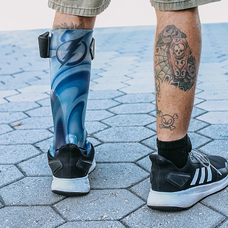 man with prosthetic leg