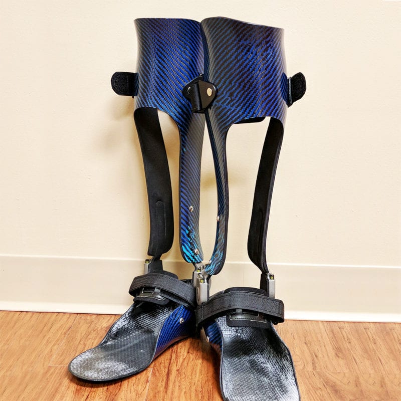 Orthotic Devices Lower Extremity Orthotics Upper Extremity Orthoses