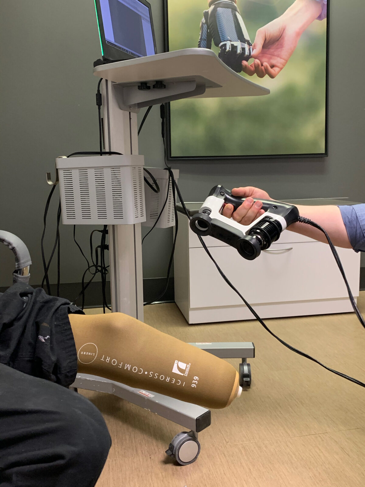 Digital Scanning of a lower extremity amputee's residual limb