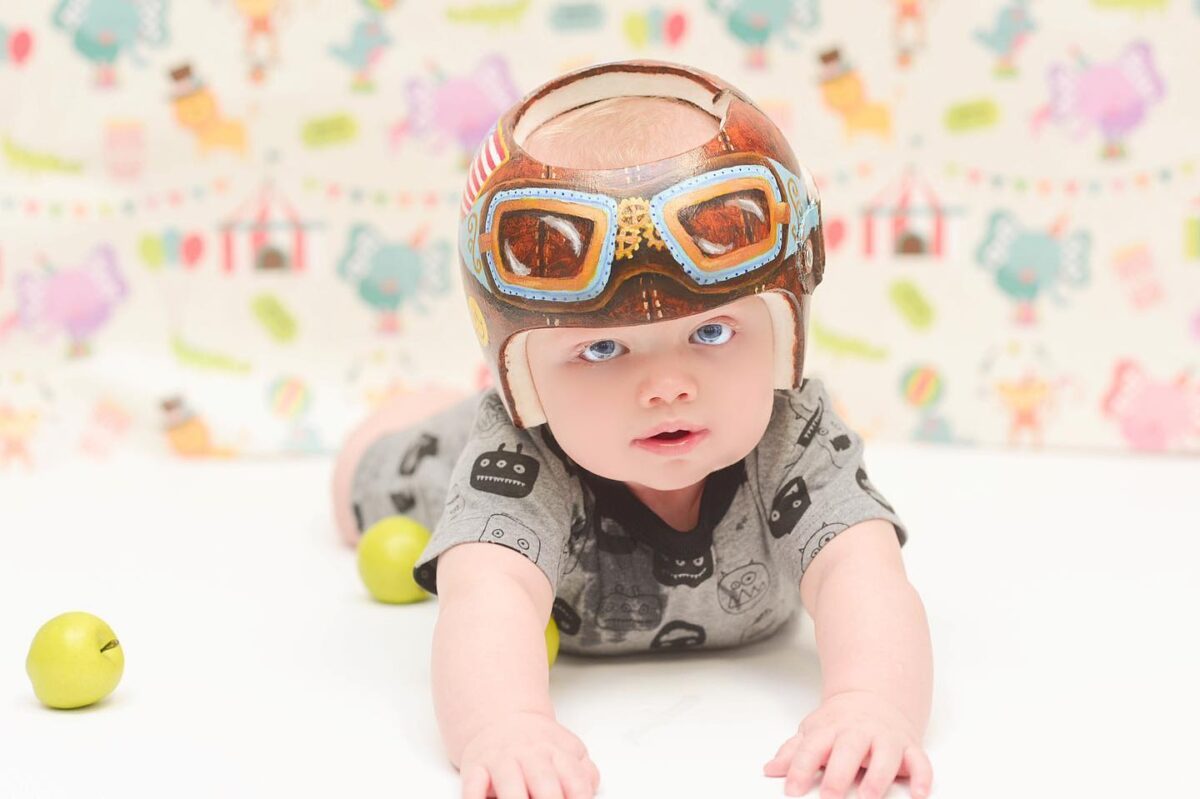 AllSTAR Cranial Program Cranial Helmet Westcoast Brace and Limb