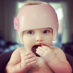 infant wearing Starband cranial remolding helmet