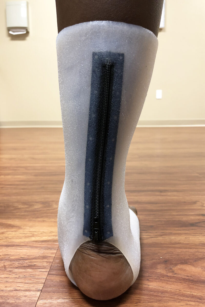 SilIcone AFO’s Blog Orthotics Westcoast Brace and Limb