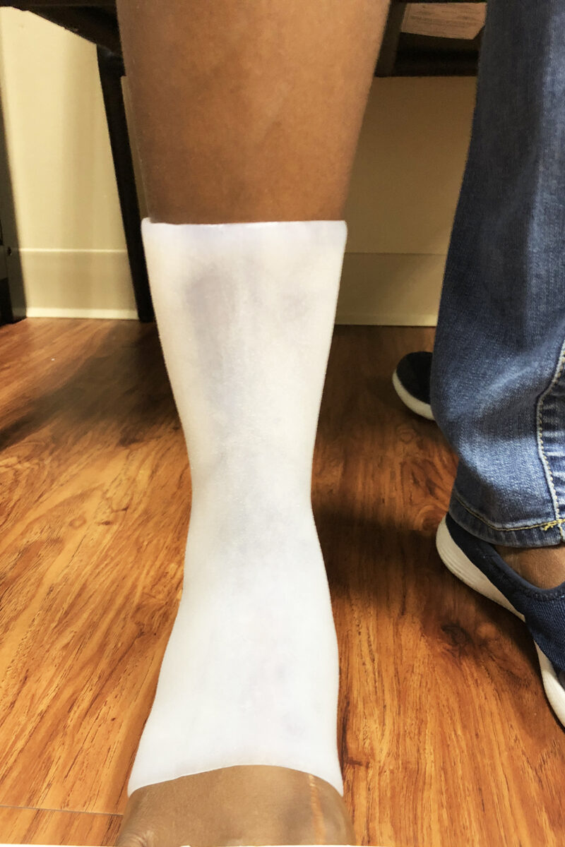 SilIcone AFO’s Blog Orthotics Westcoast Brace and Limb