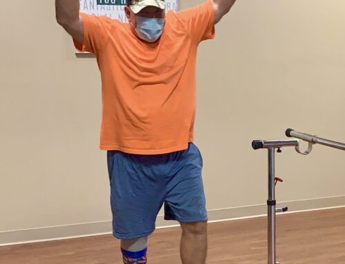 Below Knee Prosthesis – Ronald