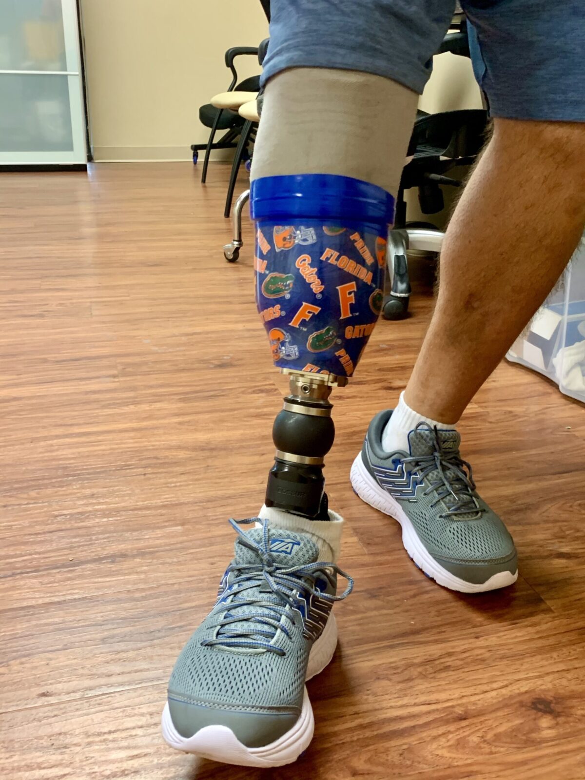 Below knee prosthetic leg with Ossur pro-flex xc torsion foot