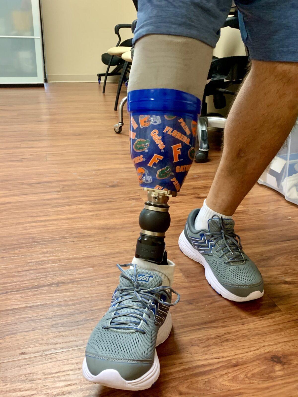 Below Knee Prosthesis - Ronald | Westcoast Brace and Limb | Testimonial