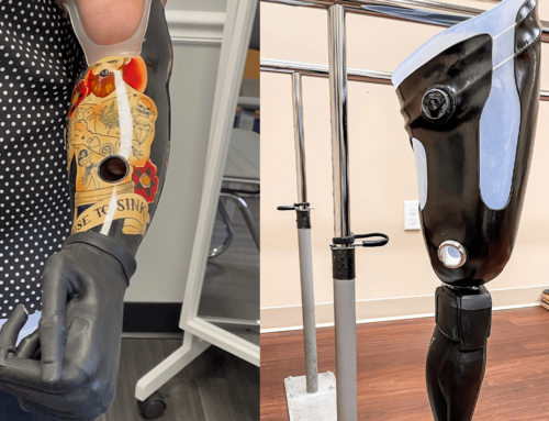 HiFi Interface Technology – Prosthetic Socket
