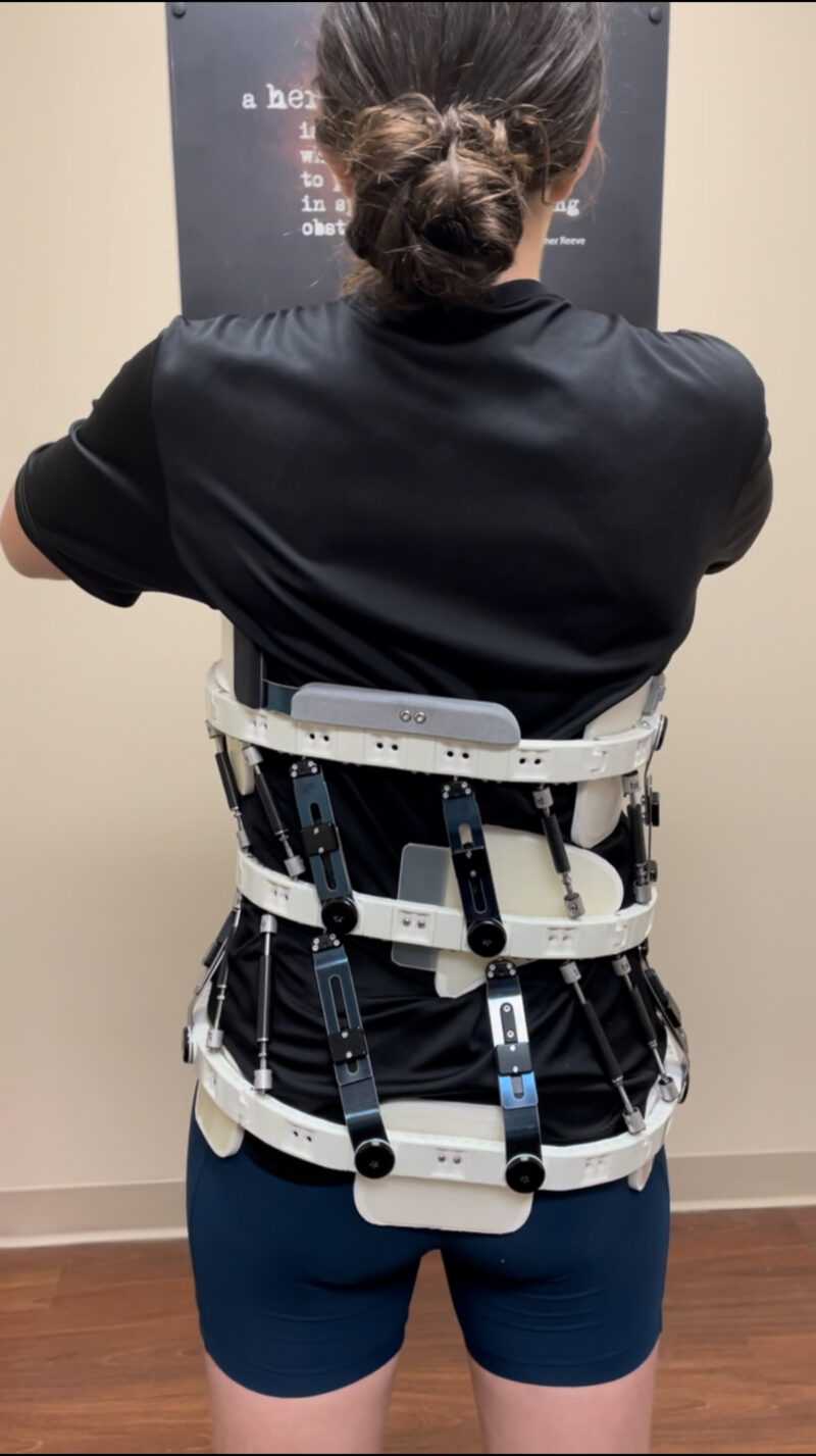 Scoliosis Bracing Scoliosis Awareness Westcoast Brace & Limb