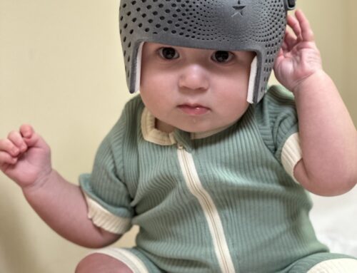 First Starband 3D Cranial helmet at WCBL