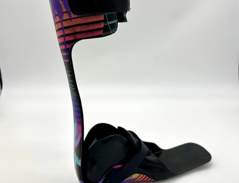 What is a Prosthesis Westcoast Brace & Limb