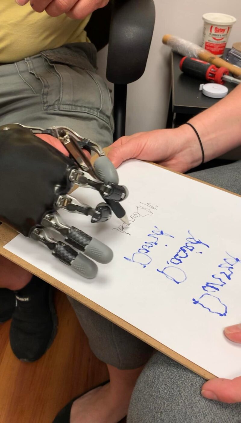 Orthotic and Prosthetic Patient Resource Blog Westcoast Brace and Limb