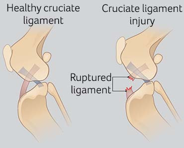 image showing health and torn cruciate ligament in dog's knee