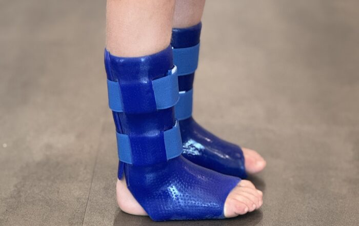 Close up of a child's lower legs and feet, wearing blue silicone ankle foot orthoses (AFOs) on both feet. The braces have velcro strap closure and are shown barefoot on a wooden floor.