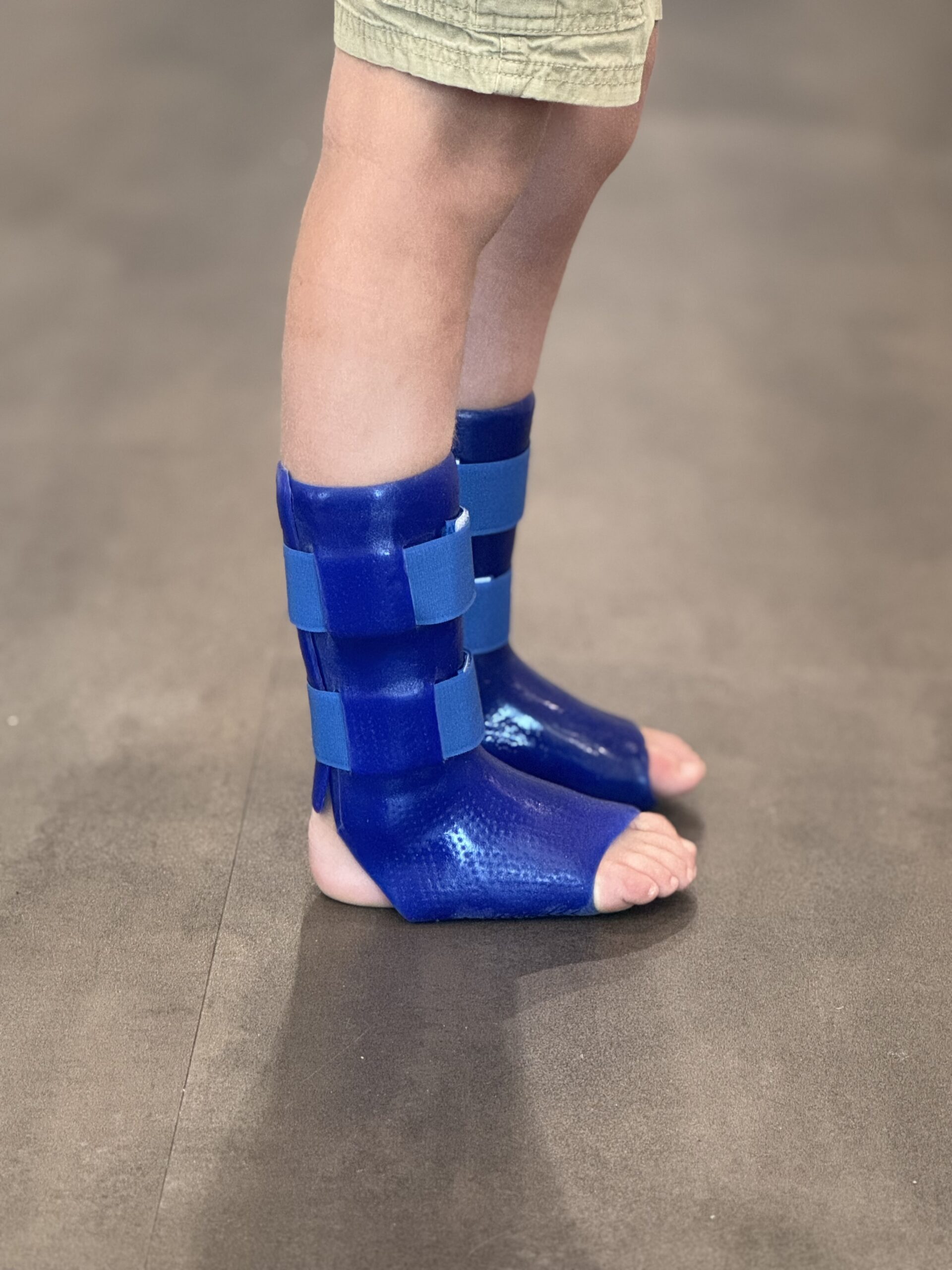 Close up of a child's lower legs and feet, wearing blue silicone ankle foot orthoses (AFOs) on both feet. The braces have velcro strap closure and are shown barefoot on a wooden floor.