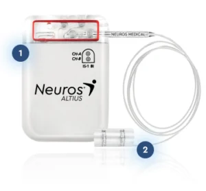 altius-implantable-pulse-generator